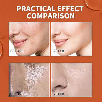 MARTIN Oil Control Lava Face Wash For Men Anti-Pimples Facial Cleanser, Keeps Your Skin Hydrating & Moisturizing, 120 ml